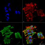 SMC-165_Alpha-B-Crystallin_Antibody_3A10C9_ICC-IF_Human_Neuroblastoma-cell-line-SK-N-BE_60XComposite-1.png