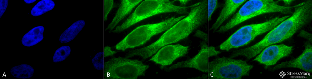 <p>Immunocytochemistry/Immunofluorescence analysis using Mouse Anti-Erp57 (Grp58) Monoclonal Antibody, Clone Map.ERP57 (SMC-168). Tissue: Heat Shocked cervical cancer cells (HeLa). Species: Human. Fixation: 2% Formaldehyde for 20 min at RT. Primary Antibody: Mouse Anti-Erp57 (Grp58) Monoclonal Antibody (SMC-168) at 1:100 for 12 hours at 4°C. Secondary Antibody: FITC Goat Anti-Mouse (green) at 1:200 for 2 hours at RT. Counterstain: DAPI (blue) nuclear stain at 1:40000 for 2 hours at RT. Localization: Endoplasmic reticulum lumen. Melanosome. Magnification: 100x. (A) DAPI (blue) nuclear stain. (B) Anti-Erp57 (Grp58) Antibody. (C) Composite. Heat Shocked at 42°C for 1h.</p>
