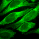 SMC-168_Erp57-Grp58_Antibody_Map.ERP57_ICC-IF_Human_Heat-Shocked-HeLa-Cells_100x_Composite.png