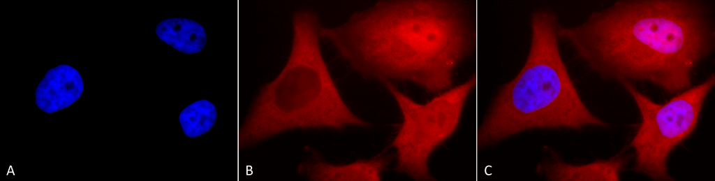 <p>Immunocytochemistry/Immunofluorescence analysis using Mouse Anti-Ubiquitin Monoclonal Antibody, Clone 6C11-B3 (SMC-171). Tissue: Cervical cancer cell line (HeLa). Species: Human. Fixation: 2% Formaldehyde for 20 min at RT. Primary Antibody: Mouse Anti-Ubiquitin Monoclonal Antibody (SMC-171) at 1:100 for 12 hours at 4°C. Secondary Antibody: APC Goat Anti-Mouse (red) at 1:200 for 2 hours at RT. Counterstain: DAPI (blue) nuclear stain at 1:40000 for 2 hours at RT. Localization: Diffuse nuclear and cytoplasmic staining. Magnification: 100x. (A) DAPI (blue) nuclear stain. (B) Anti-Ubiquitin Antibody. (C) Composite.</p>
