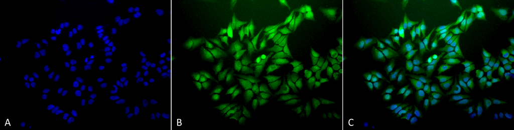 <p>Immunocytochemistry/Immunofluorescence analysis using Mouse Anti-Ubiquitin Monoclonal Antibody, Clone 6C11-B3 (SMC-171). Tissue: Cervical cancer cell line (HeLa). Species: Human. Fixation: 2% Formaldehyde for 20 min at RT. Primary Antibody: Mouse Anti-Ubiquitin Monoclonal Antibody (SMC-171) at 1:100 for 12 hours at 4°C. Secondary Antibody: FITC Goat Anti-Mouse (green) at 1:200 for 2 hours at RT. Counterstain: DAPI (blue) nuclear stain at 1:40000 for 2 hours at RT. Localization: Diffuse nuclear and cytoplasmic staining. Magnification: 20x. (A) DAPI (blue) nuclear stain. (B) Anti-Ubiquitin Antibody. (C) Composite.</p>
