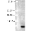 Mouse Anti-Ubiquitin Antibody [6C11-B3] used in Western Blot (WB) on Human Cell lysates (SMC-171)