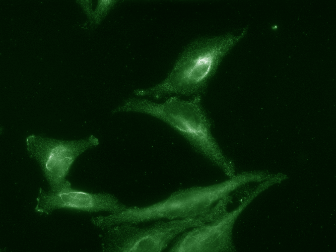 <p>使用大鼠抗 Aha1 单克隆抗体克隆 25F2.D9 (SMC-172) 进行免疫细胞化学/免疫荧光分析。 组织：宫颈癌细胞系（HeLa）。 种族：人类。 一抗：大鼠抗 Aha1 单克隆抗体 (SMC-172)，浓度为 1:1000。 二抗：FITC Goat Anti-Rat（绿色）。</p>