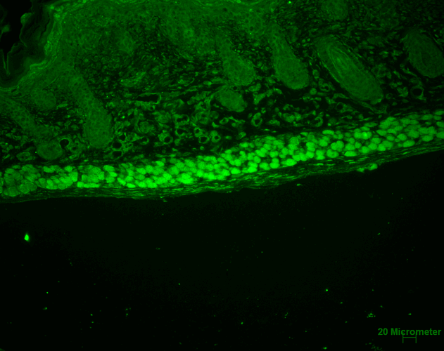<p>使用大鼠抗 Aha1 单克隆抗体克隆 25F2.D9 (SMC-172) 进行免疫组织化学分析。 组织：背皮。 种类：老鼠。 固定：Bouin 固定液和石蜡包埋。 一抗：大鼠抗 Aha1 单克隆抗体 (SMC-172) 以 1:100 在室温下作用 1 小时。 二抗：FITC Goat Anti-Rat（绿色）在 1:50 在 RT 中作用 1 小时。 定位：最上层表皮染色，和肌肉。</p>