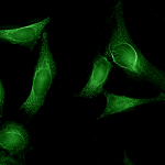 SMC-173_Aha1_Antibody_25F2.D10_ICC-IF_Human_HeLa-cells_1.png