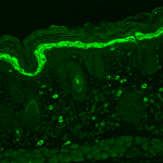 SMC-174_Phosphotyrosine_Antibody_G104_IHC_Mouse_backskin_2.png