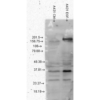 Mouse Anti-Phosphotyrosine Antibody [G104] used in Western Blot (WB) on Human A431 cell lysates (SMC-174)