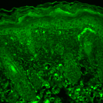 SMC-177_Rhodopsin_Antibody_1D4_IHC_Mouse_backskin_1.png