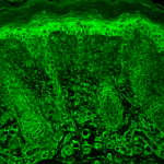 SMC-184_HIF1-alpha_Antibody_ESEE122_IHC_Mouse_backskin_1.png