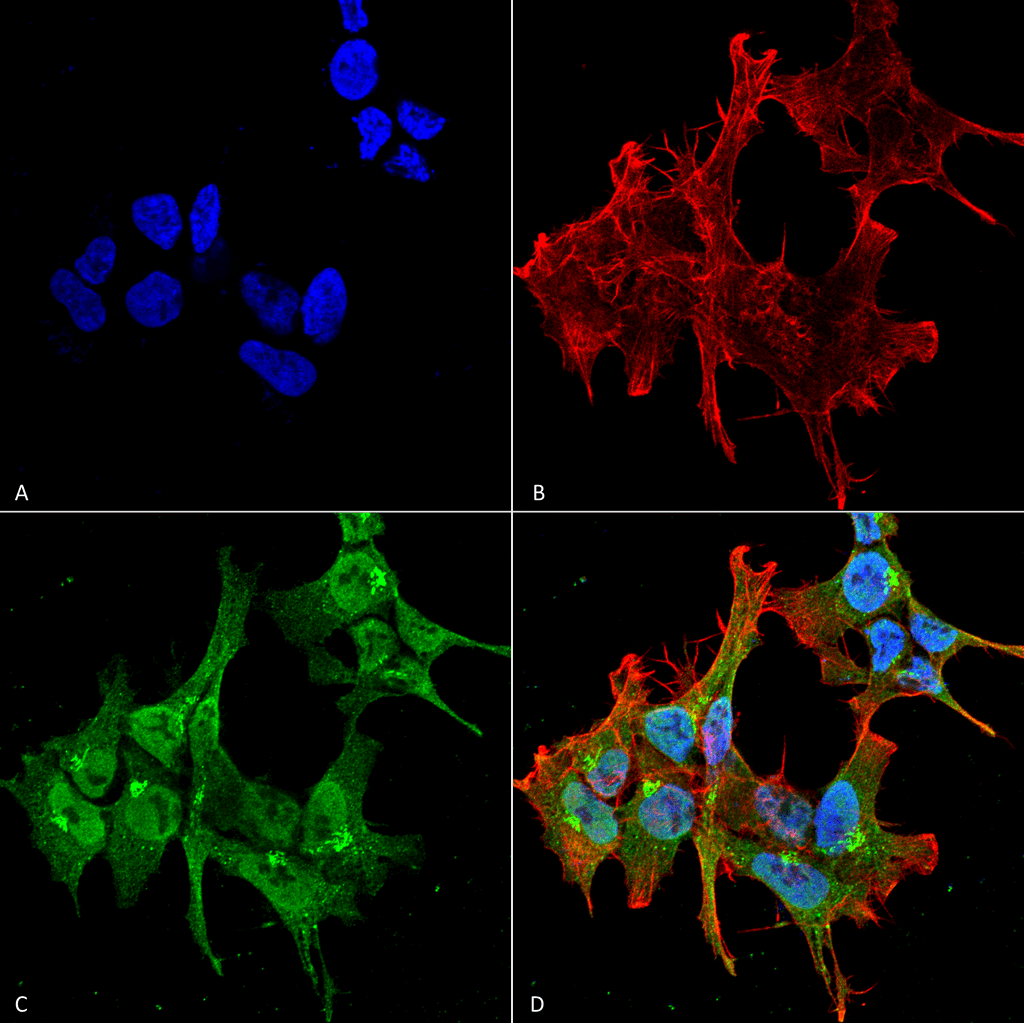 <p>Immunocytochemistry/Immunofluorescence analysis using Mouse Anti-Piccolo Monoclonal Antibody, Clone 6H9-B6 (SMC-188). Tissue: Neuroblastoma cell line (SK-N-BE). Species: Human. Fixation: 4% Formaldehyde for 15 min at RT. Primary Antibody: Mouse Anti-Piccolo Monoclonal Antibody (SMC-188) at 1:100 for 60 min at RT. Secondary Antibody: Goat Anti-Mouse ATTO 488 at 1:100 for 60 min at RT. Counterstain: Phalloidin Texas Red F-Actin stain; DAPI (blue) nuclear stain at 1:1000, 1:5000 for 60min RT, 5min RT. Localization: Cytoplasm, Endoplasmic Reticulum, Nucleus. Magnification: 60X. (A) DAPI (blue) nuclear stain. (B) Phalloidin Texas Red F-Actin stain. (C) Piccolo Antibody. (D) Composite.</p>
