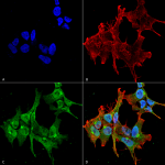 SMC-188-Piccolo-Antibody-6H9-B6-ICC-IF-Human-Neuroblastoma-cell-line-SK-N-BE-60X-Composite-1.png