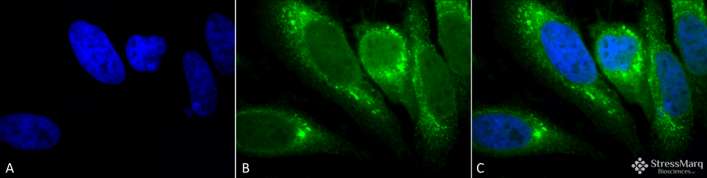 <p>Immunocytochemistry/Immunofluorescence analysis using Mouse Anti-GRP78 Monoclonal Antibody, Clone 1H11-1H7 (SMC-195). Tissue: Heat Shocked cervical cancer cells (HeLa). Species: Human. Fixation: 2% Formaldehyde for 20 min at RT. Primary Antibody: Mouse Anti-GRP78 Monoclonal Antibody (SMC-195) at 1:100 for 12 hours at 4°C. Secondary Antibody: FITC Goat Anti-Mouse (green) at 1:200 for 2 hours at RT. Counterstain: DAPI (blue) nuclear stain at 1:40000 for 2 hours at RT. Localization: Endoplasmic reticulum lumen. Melanosome. Magnification: 100x. (A) DAPI (blue) nuclear stain. (B) Anti-GRP78 Antibody. (C) Composite. Heat Shocked at 42°C for 1h.</p>
