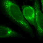 SMC-195_GRP78_Antibody_1H11-1H7_ICC-IF_Human_Heat-Shocked-HeLa-Cells_100x_Composite.png