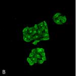 SMC-196-GRP78-Antibody-6H4-2G7-ICC-IF-Human-Cervical-Cancer-cell-line-HeLa-60X-Composite-1.png