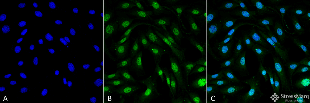 <p>Immunocytochemistry/Immunofluorescence analysis using Mouse Anti-MDC1 Monoclonal Antibody, Clone P2B11 (SMC-197). Tissue: Fibroblast cell line (NIH 3T3). Species: Mouse. Fixation: 4% Formaldehyde for 15 min at RT. Primary Antibody: Mouse Anti-MDC1 Monoclonal Antibody (SMC-197) at 1:100 for 60 min at RT. Secondary Antibody: Goat Anti-Mouse ATTO 488 at 1:100 for 60 min at RT. Counterstain: DAPI (blue) nuclear stain at 1:5000 for 5 min RT. Localization: Nucleus. Magnification: 60X.</p>

