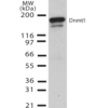 Mouse Anti-DNMT1 Antibody [60B1220.1] used in Western Blot (WB) on Human H1299 cell lysate (SMC-200)