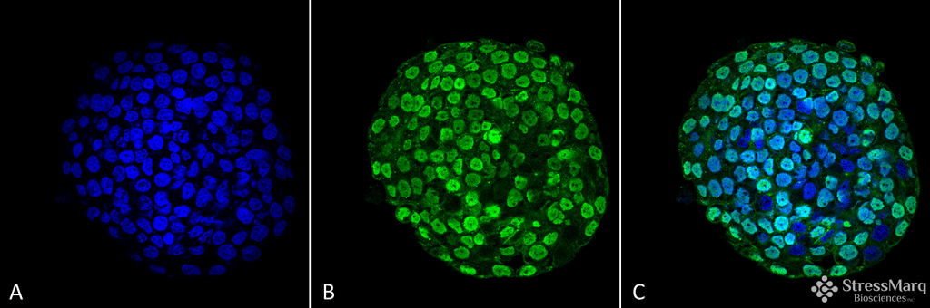 <p>Immunocytochemistry/Immunofluorescence analysis using Mouse Anti-CENP-A Monoclonal Antibody, Clone 5A7-2E11 (SMC-202). Tissue: Colon cancer cell line (HT-29). Species: Human. Fixation: 4% Formaldehyde for 15 min at RT. Primary Antibody: Mouse Anti-CENP-A Monoclonal Antibody (SMC-202) at 1:100 for 60 min at RT. Secondary Antibody: Goat Anti-Mouse ATTO 488 at 1:100 for 60 min at RT. Counterstain: DAPI (blue) nuclear stain at 1:5000 for 5 min RT. Localization: Nucleus. Magnification: 60X.</p>
