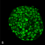 SMC-202-CENP-A-Antibody-5A7-2E11-ICC-IF-Human-Colon-cancer-cell-line-HT-29-60X-Composite-1.png