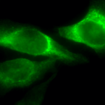 SMC-203_Hsp47_Antibody_1C4-1A6_ICC-IF_Human_Heat-Shocked-HeLa-Cells_100x_Composite.png