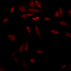 Mouse Anti-Hsp47 Antibody [1C4-1A6] used in Immunocytochemistry/Immunofluorescence (ICC/IF) on Human Heat Shocked cervical cancer cells (HeLa) (SMC-203)