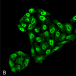 SMC-204-EndoPDI-Antibody-2E7-7-ICC-IF-Human-Cervical-Cancer-cell-line-HeLa-60X-Composite-1.png