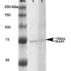 Mouse Anti-Trap1 Antibody [3H4-2H6] used in Western Blot (WB) on Human, Rat Human A431 and Rat Brain Membrane cell lysates (SMC-207)