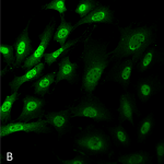 SMC-213-Ubiquitin-Antibody-FK1-ICC-IF-Mouse-Fibroblast-cell-line-NIH-3T3-60X-Composite-1.png