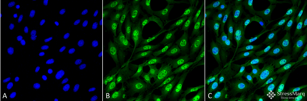 <p>Immunocytochemistry/Immunofluorescence analysis using Mouse Anti-Ubiquitin Monoclonal Antibody, Clone FK2 (SMC-214). Tissue: Fibroblast cell line (NIH 3T3). Species: Mouse. Fixation: 4% Formaldehyde for 15 min at RT. Primary Antibody: Mouse Anti-Ubiquitin Monoclonal Antibody (SMC-214) at 1:100 for 60 min at RT. Secondary Antibody: Goat Anti-Mouse ATTO 488 at 1:100 for 60 min at RT. Counterstain: DAPI (blue) nuclear stain at 1:5000 for 5 min RT. Localization: Nucleus, Cytoplasm. Magnification: 60X.</p>
