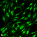 SMC-214-Ubiquitin-Antibody-FK2-ICC-IF-Mouse-Fibroblast-cell-line-NIH-3T3-60X-Composite-1.png