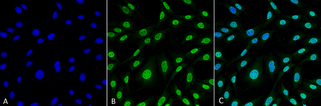 <p>Immunocytochemistry/Immunofluorescence analysis using Mouse Anti-HO-1 (Rat) Monoclonal Antibody, Clone 6B8-2F2 (SMC-234). Tissue: Fibroblast cell line (NIH 3T3). Species: Mouse. Fixation: 4% Formaldehyde for 15 min at RT. Primary Antibody: Mouse Anti-HO-1 (Rat) Monoclonal Antibody (SMC-234) at 1:100 for 60 min at RT. Secondary Antibody: Goat Anti-Mouse ATTO 488 at 1:100 for 60 min at RT. Counterstain: DAPI (blue) nuclear stain at 1:5000 for 5 min RT. Localization: Nucleus, Cytoplasm. Magnification: 60X.</p>
