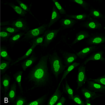SMC-234-HO-1-Rat-Antibody-6B8-2F2-ICC-IF-Mouse-Fibroblast-cell-line-NIH-3T3-60X-Composite-1.png