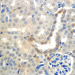 SMC-240-ENaC-beta-Antibody-7B8-IHC-Mouse-Kidney-cortex-60X-1.png