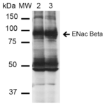 SMC-241-ENaC-beta-Antibody-16E4-WB-Mouse-Whole-kidney-homogenates-1.png