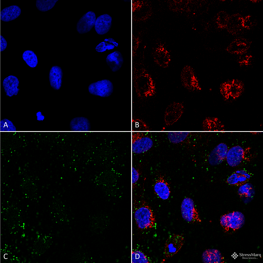 <p>Immunocytochemistry/Immunofluorescence analysis using Mouse Anti-HSP70 Monoclonal Antibody, Clone 1H11 (SMC-249). Tissue: HCT116 cells. Species: Human. Fixation: 4% Formaldehyde. Primary Antibody: Mouse Anti-HSP70 Monoclonal Antibody (SMC-249) at 1:100. Counterstain: Wheat germ agglutinin Texas red membrane marker; DAPI (blue) nuclear stain. Localization: Cell surface, faint intracellular. (A) DAPI nuclear stain. (B) Wheat germ agglutinin Texas red. (C) HSP70 Antibody. (D) Composite. Courtesy of: Lawrence Hightower, Charles Giardina, and Didem Ozcan from University of Connecticut.</p>
