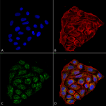 SMC-267_CD74_Antibody_1B8_ICC-IF_Human_HeLa-Cells-Human-Cervical-Cancer_60X_Composite_1.png