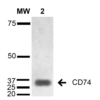 Mouse Anti-CD74 Antibody [1B8] used in Western Blot (WB) on Human Lymphoblastoid cell line (Raji) (SMC-267)