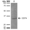 Mouse Anti-CD74 Antibody [3D7] used in Western Blot (WB) on Human Lymphoblastoid cell line (Raji) (SMC-268)
