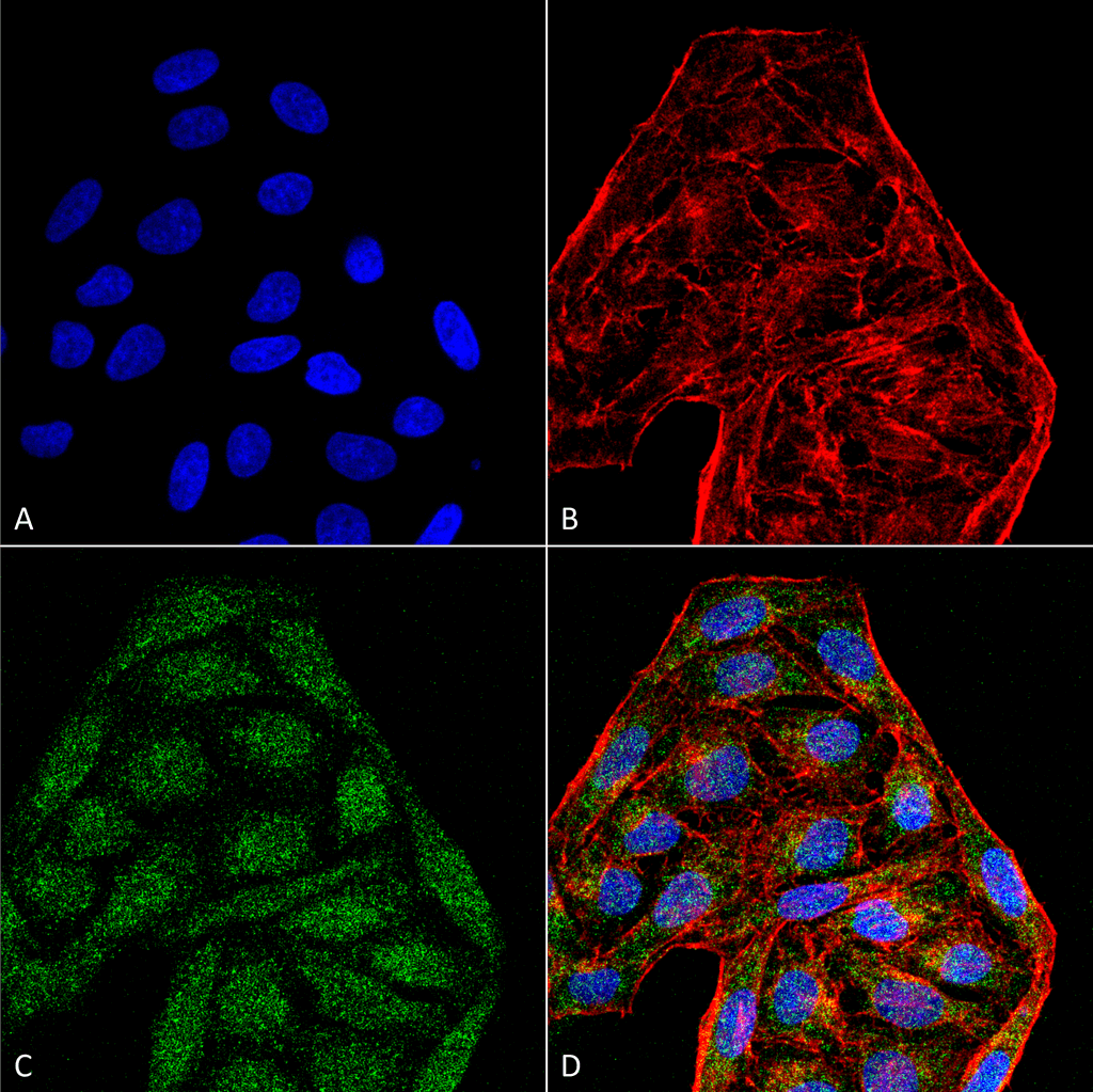 <p>Immunocytochemistry/Immunofluorescence analysis using Mouse Anti-CD74 Monoclonal Antibody, Clone 6D9  (SMC-269). Tissue: Cervical cancer cell line (HeLa). Species: Human. Fixation: 4% Formaldehyde for 15 min at RT. Primary Antibody: Mouse Anti-CD74 Monoclonal Antibody (SMC-269) at 1:100 for 60 min at RT. Secondary Antibody: Goat Anti-Mouse ATTO 488 at 1:200 for 60 min at RT. Counterstain: Phalloidin Texas Red F-Actin stain; DAPI (blue) nuclear stain at 1:1000, 1:5000 for 60 min at RT, 5 min at RT. Localization: Cell membrane, Endoplasmic Reticulum, Golgi apparatus. Magnification: 60X. (A) DAPI (blue) nuclear stain. (B) Phalloidin Texas Red F-Actin stain. (C) CD74 Antibody. (D) Composite.</p>
