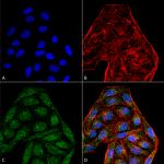 SMC-269_CD74_Antibody_6D9_ICC-IF_Human_HeLa-Cells-Human-Cervical-Cancer_60X_Composite_1.png