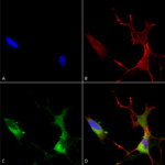 SMC-300_Cav1.2_Antibody_S57_ICC-IF_Human_Neuroblastoma-cells-SH-SY5Y-Composite-1.png