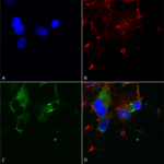 SMC-301_Cav1.3_Antibody_S48_ICC-IF_Human_Neuroblastoma-cells-SH-SY5Y-Composite-1.png