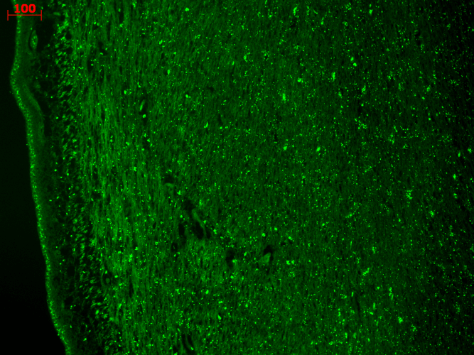 Anti Cav3 2 Antibody S55 10 Monoclonal Igg1 Stressmarq Biosciences Inc Anti Cav3 2 Antibody S55 10 Monoclonal Igg1 Stressmarq Biosciences Inc