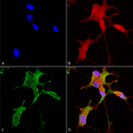 SMC-303_Cav32_Antibody_N55-10_ICC-IF_Human_Neuroblastoma-cells-SH-SY5Y-Composite-1.png