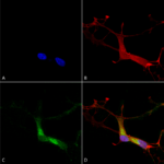 SMC-304_HCN1_Antibody_S70_ICC-IF_Human_Neuroblastoma-cells-SH-SY5Y-Composite-1.png