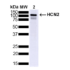 Mouse Anti-HCN2 Antibody [S71] used in Western Blot (WB) on Mouse Brain (SMC-305)