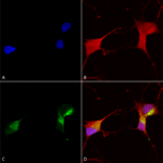 SMC-307_KCNQ1_Antibody_N37A-10_ICC-IF_Human_Neuroblastoma-cells-SH-SY5Y-Composite-1.png