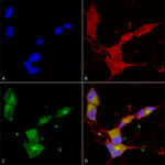 SMC-309_KCNQ4_Antibody_N43-6_ICC-IF_Human_Neuroblastoma-cells-SH-SY5Y-Composite-1.png