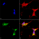 SMC-310_Kir21_Antibody_S112_ICC-IF_Human_Neuroblastoma-cells-SH-SY5Y-Composite-1.png