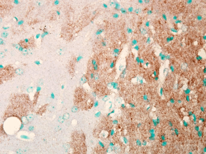 Nav1.7 Antibody, Clone N68/6