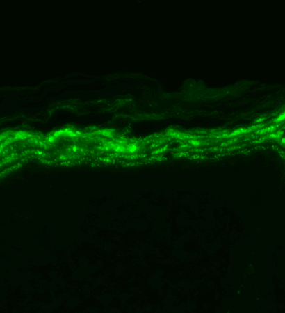 Nav1.7 Antibody, Clone N68/6